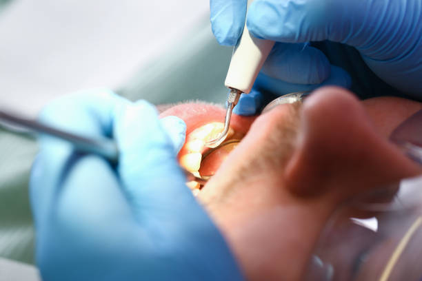 Best Emergency Treatment for Jaw Pain or Injury in Richland, MS